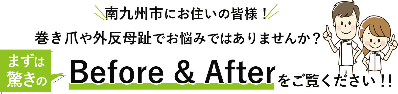 南九州市にお住いの皆様。巻き爪や外反母趾でお悩みではありませんか。まずは驚きのビフォーアフターをご覧ください