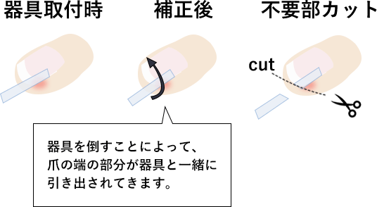 器具の取り付け、補正