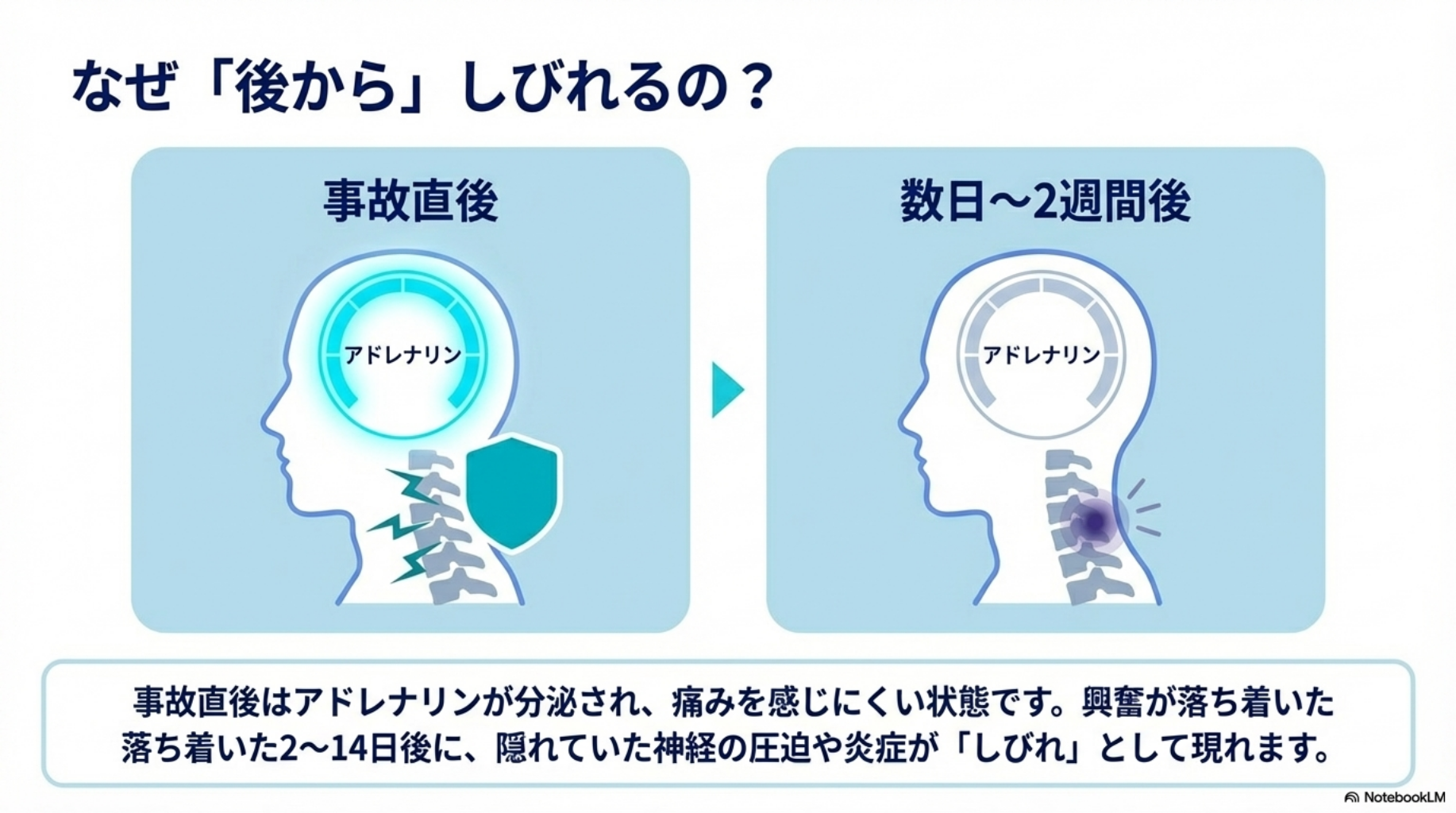 交通事故後にしびれが後から出る理由