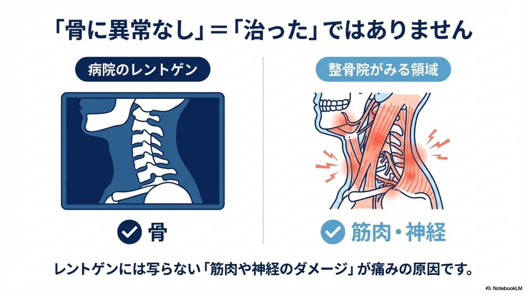 レントゲンで異常が無くても治ったことにはなりません